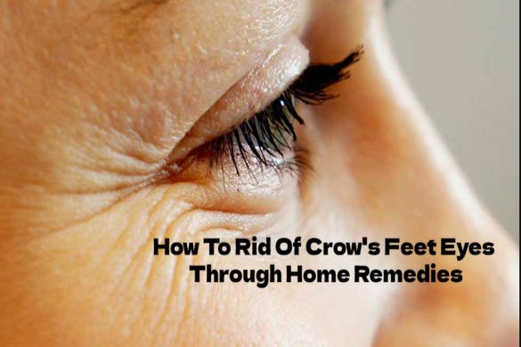 How To Rid Of Crows Feet Eyes Through Home Remedies